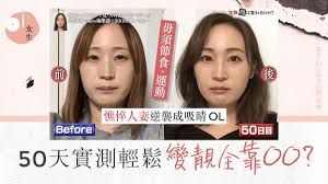 整容合集