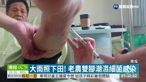 指甲和脚外科医院合集